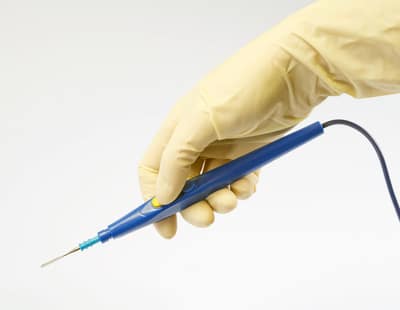 surgeon hand holding a blue electric scalpel