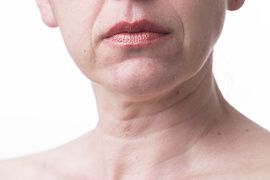 Furrowed lips of a mature woman.Signs of aging skin after 40